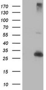 RFXANK Antibody in Western Blot (WB)