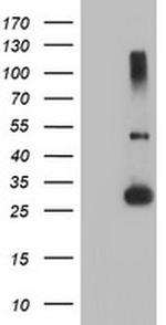 RFXANK Antibody in Western Blot (WB)