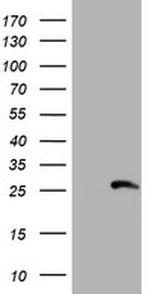 RFXANK Antibody in Western Blot (WB)