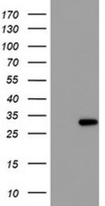 RFXANK Antibody in Western Blot (WB)