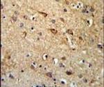 RGR Antibody in Immunohistochemistry (IHC)