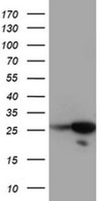 RGS16 Antibody in Western Blot (WB)