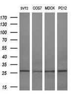 RGS16 Antibody in Western Blot (WB)