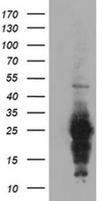 RGS16 Antibody in Western Blot (WB)
