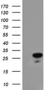 RGS16 Antibody in Western Blot (WB)