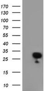 RGS16 Antibody in Western Blot (WB)