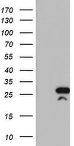 RGS16 Antibody in Western Blot (WB)