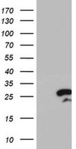 RGS16 Antibody in Western Blot (WB)
