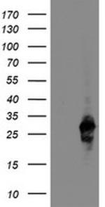 RGS16 Antibody in Western Blot (WB)