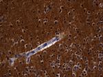 RGS17 Antibody in Immunohistochemistry (Paraffin) (IHC (P))