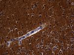 RGS17 Antibody in Immunohistochemistry (Paraffin) (IHC (P))