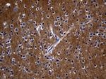 RGS17 Antibody in Immunohistochemistry (Paraffin) (IHC (P))