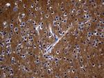 RGS17 Antibody in Immunohistochemistry (Paraffin) (IHC (P))