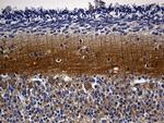 RGS17 Antibody in Immunohistochemistry (Paraffin) (IHC (P))