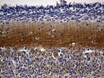 RGS17 Antibody in Immunohistochemistry (Paraffin) (IHC (P))