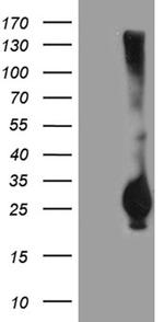 RGS17 Antibody in Western Blot (WB)