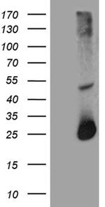 RGS17 Antibody in Western Blot (WB)