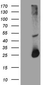 RGS17 Antibody in Western Blot (WB)
