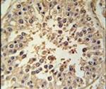 RGS22 Antibody in Immunohistochemistry (IHC)
