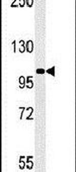 RGS22 Antibody in Western Blot (WB)