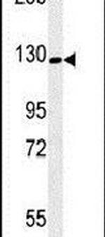 RGS22 Antibody in Western Blot (WB)