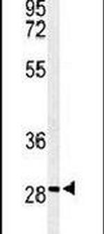 ARHGAP19 Antibody in Western Blot (WB)
