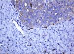 RHOJ Antibody in Immunohistochemistry (Paraffin) (IHC (P))