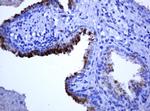 RHOJ Antibody in Immunohistochemistry (Paraffin) (IHC (P))