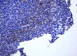 RHOJ Antibody in Immunohistochemistry (Paraffin) (IHC (P))