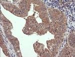 RHOJ Antibody in Immunohistochemistry (Paraffin) (IHC (P))