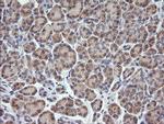 RHOJ Antibody in Immunohistochemistry (Paraffin) (IHC (P))