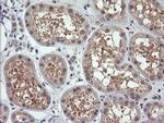 RHOJ Antibody in Immunohistochemistry (Paraffin) (IHC (P))