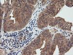 RHOJ Antibody in Immunohistochemistry (Paraffin) (IHC (P))