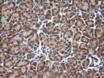 RHOJ Antibody in Immunohistochemistry (Paraffin) (IHC (P))