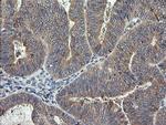 RHOJ Antibody in Immunohistochemistry (Paraffin) (IHC (P))