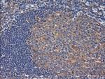 RHOJ Antibody in Immunohistochemistry (Paraffin) (IHC (P))
