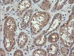 RHOJ Antibody in Immunohistochemistry (Paraffin) (IHC (P))