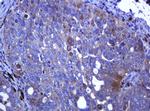 RHOJ Antibody in Immunohistochemistry (Paraffin) (IHC (P))