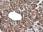 RHOJ Antibody in Immunohistochemistry (Paraffin) (IHC (P))
