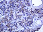 RHOJ Antibody in Immunohistochemistry (Paraffin) (IHC (P))