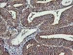 RHOJ Antibody in Immunohistochemistry (Paraffin) (IHC (P))