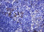 RHOJ Antibody in Immunohistochemistry (Paraffin) (IHC (P))