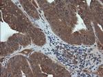 RHOJ Antibody in Immunohistochemistry (Paraffin) (IHC (P))
