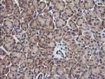 RHOJ Antibody in Immunohistochemistry (Paraffin) (IHC (P))