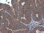 RHOJ Antibody in Immunohistochemistry (Paraffin) (IHC (P))