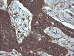 RHOJ Antibody in Immunohistochemistry (Paraffin) (IHC (P))
