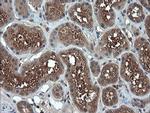 RHOJ Antibody in Immunohistochemistry (Paraffin) (IHC (P))