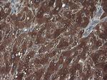 RHOJ Antibody in Immunohistochemistry (Paraffin) (IHC (P))