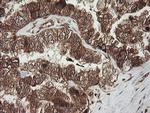 RHOJ Antibody in Immunohistochemistry (Paraffin) (IHC (P))