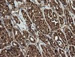 RHOJ Antibody in Immunohistochemistry (Paraffin) (IHC (P))